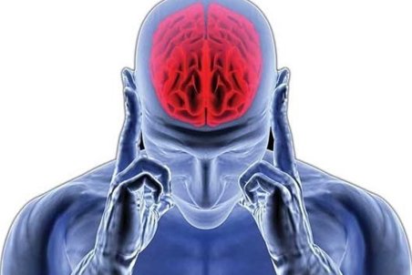 چه عواملی باعث ابتلا به "سکته مغزی" می‌شوند؟