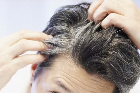 "اضطراب و استرس" باعث خاکستری شدن مو می‌شود