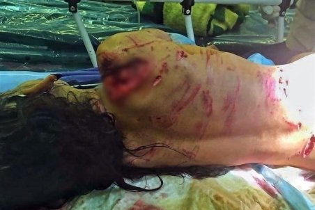 دریده شدن "دختربچه گلفروش" توسط سگ‌های خیابانی + عکس