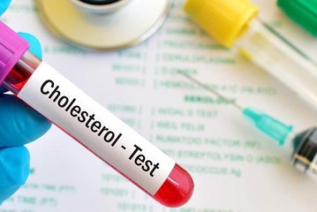 نشانه‌های شگفت انگیز کلسترول بالا را بشناسید