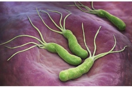 میکروب معده بیماری عفونی، قابل انتقال به دیگران