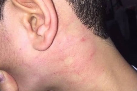 اخراج ناظم مدرسه به دلیل ضرب و شتم دانش آموز تبریزی