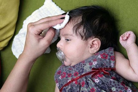 عرق کردن زیاد کودک چه علتی دارد؟