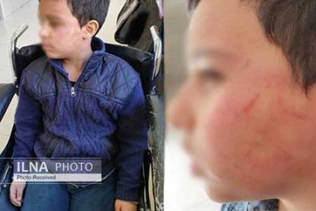 تنبیه بدنی دانش‌آموز ۱۰ساله توسط معلم ورزش