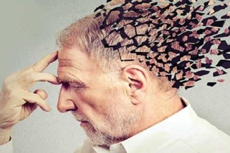 علائم آلزایمر را بشناسید