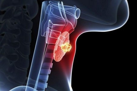 روش‌های تشخیص کم کاری تیروئید