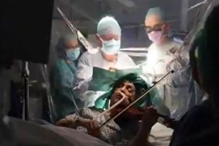 ویولن زدن یک بیمار حین عمل جراحی مغز + فیلم