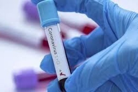 شبیه سازی کیت تشخیصی کرونا در کشور