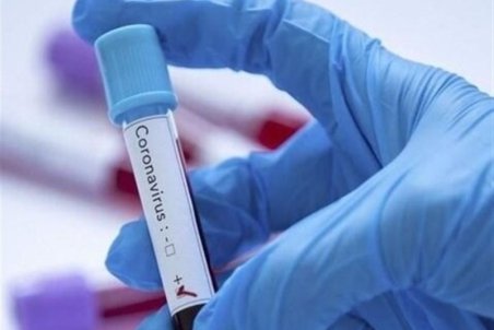 رئیس انستیتو پاستور: می‌توانیم روزانه ۱۲۰۰ تست کرونا انجام دهیم