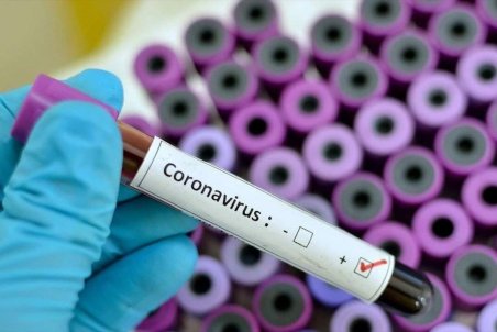 ابتلای قطعی ۲۸ نفر به کرونا در آذربایجان شرقی