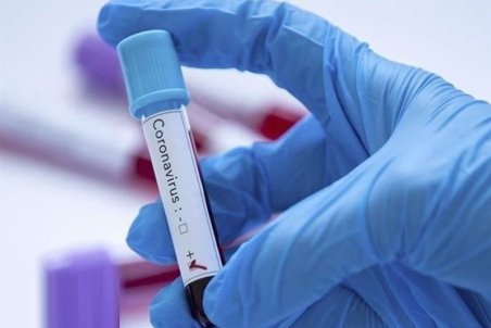 ثبت ۱۸ مورد جدید ابتلا به کرونا در استان مرکزی