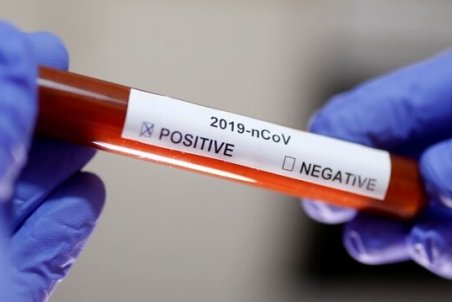 آیا کرونا از مادر به جنین یا نوزاد منتقل می‌شود؟