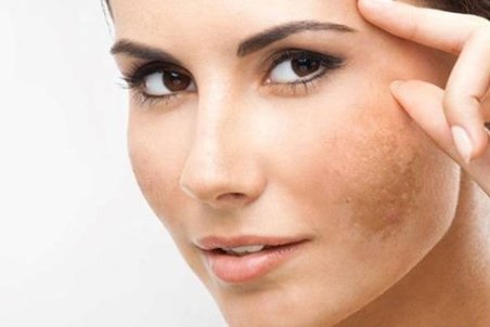 رفع لک صورت؛ چند روش که به دردتان می‌خورد