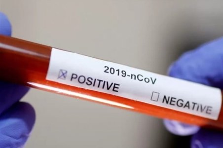 آمار مبتلایان به کرونا در استان کردستان به ۶۶ نفر افزایش یافت