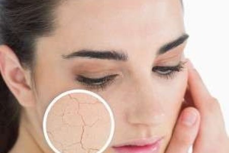 استفاده از صابون های حاوی گلیسیرین برای پیشگیری از اگزما و خشکی پوست