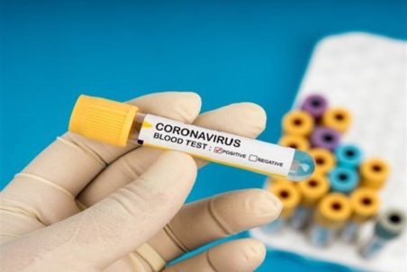 کاهش روند فوتی‌های گیلان بر اثر کرونا؛ ۴۰ درصد استان غربالگری شده است