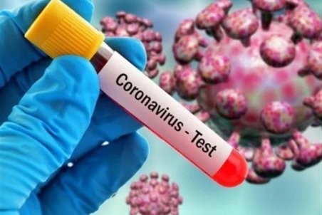 نتایج آزمایش ۴۹ نفر تا شامگاه دیروز در استان مثبت شده است