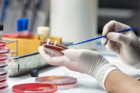 سپسیس؛ دلیل عمده مرگ ناشی از کروناویروس