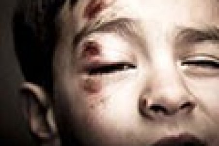 افزایش کودک آزاری نسبت به قبل از دوران کرونا