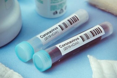 چه زمانی وضعیت بیماری کرونا همانند آنفلوانزا خواهد شد؟