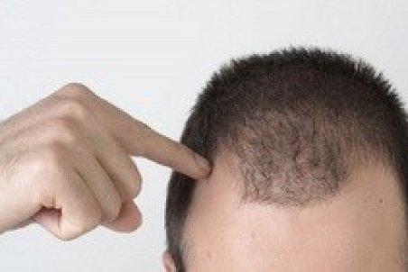 برای رشد مو چه چیزی باید بخوریم ؟