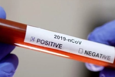 پلاسما درمانی، راهی برای مقابله با کرونا