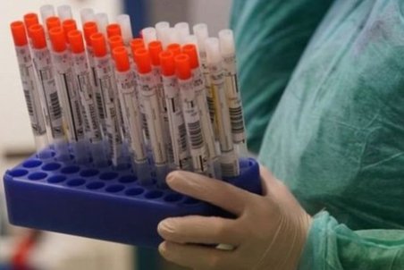 تست کرونا را چطور می‌گیرند و دقت این تست‌ها چقدر است؟