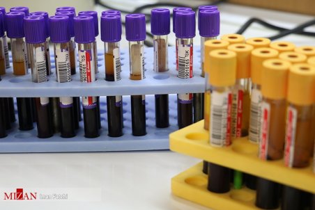 همه چیز درباره پلاسمادرمانی