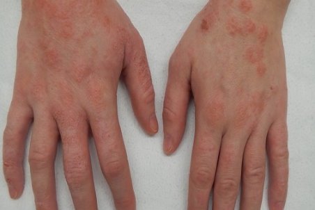 کویر کوچک، کادو پیشگیری غلط از ویروس کرونا