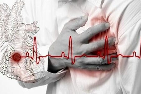 کُشنده‌ترین بیماری قلبی چیست؟