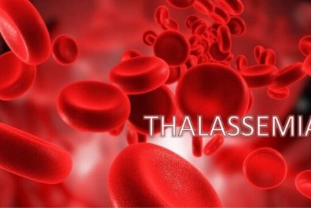 به دلایل غیرمنطقی، هنوز نوزادان تالاسمی به دنیا می‌آیند