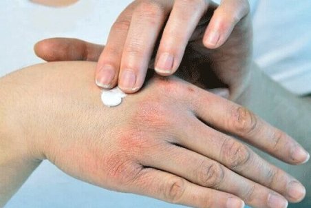 چرا پوست "خُشک" می‌شود؟