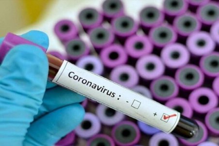 شناسایی ۱۰ مورد جدید ابتلا به کرونا در شاهرود