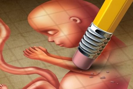 ناگفته‌هایی درباره سقط جنین زیرپله‌ای