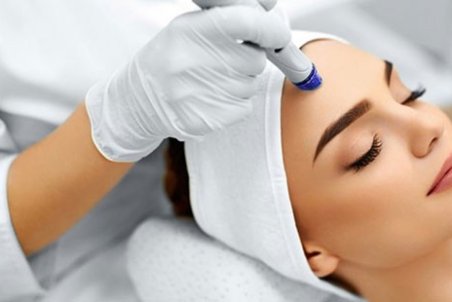 مزونیدلینگ؛ روش جدید جوان‌سازی پوست