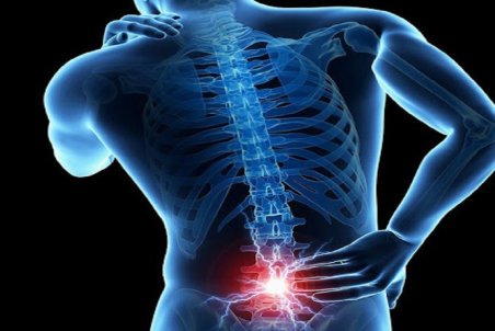 ۱۳ علت درد گودی کمر که ممکن است شما را شگفت زده کند