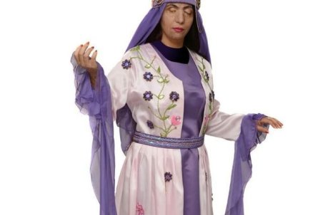 گفت‌وگو با قربانی اسیدپاشی که پس از بازیگری این‌بار مدل شد