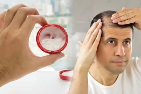 ریزش مو را با این گیاه معجزه گر درمان کنید