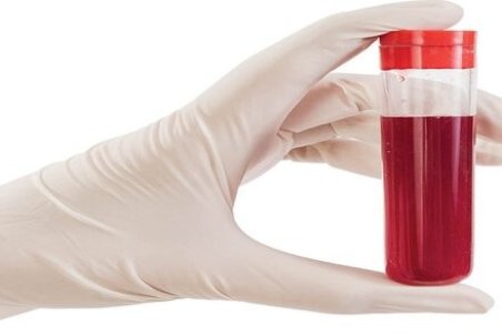 علایمی که می‌گویند گردش خون شما مشکل دارد