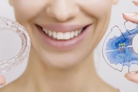 ارتودنسی دندان، انواع و قیمت سال ۹۹