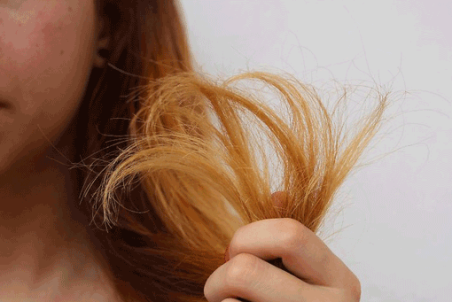 برای درمان موخوره چه کار کنم؟