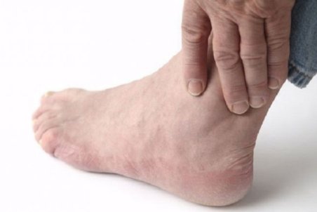 رفع سیاهی قوزک پا با چند ترفند ساده