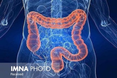 علائم سندروم روده تحریک پذیر چیست؟