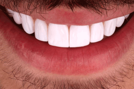 لمینیت ارزان