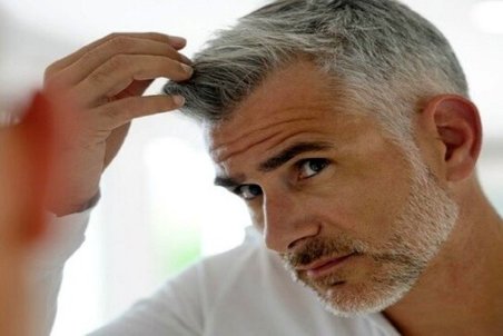 آیا می‌توان از سفید شدن مو‌ها جلوگیری کرد؟