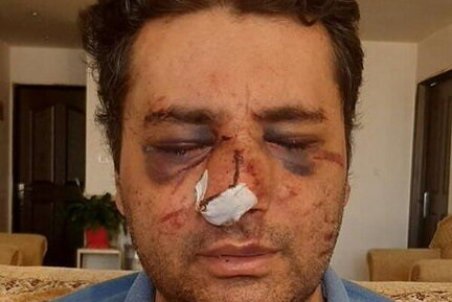 ضرب و شتم یک متخصص بیهوشی در پیرانشهر