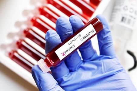 ۸۲ مورد جدید مبتلا به کرونا در بیمارستان‌های کرمان بستری شدند