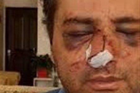 ۳ نفر از ضاربان پزشک پیرانشهری دستگیر شدند؛ بررسی پرونده توسط مراجع قضائی