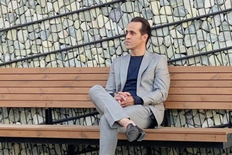 علی کریمی هنوزبا بیماری آلوپسی آره آتا درگیر است؟