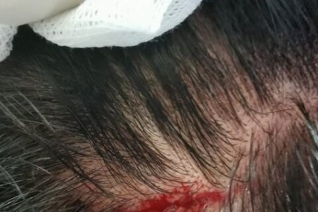 ضرب و شتم پزشک متخصص توسط همراهان بیمار